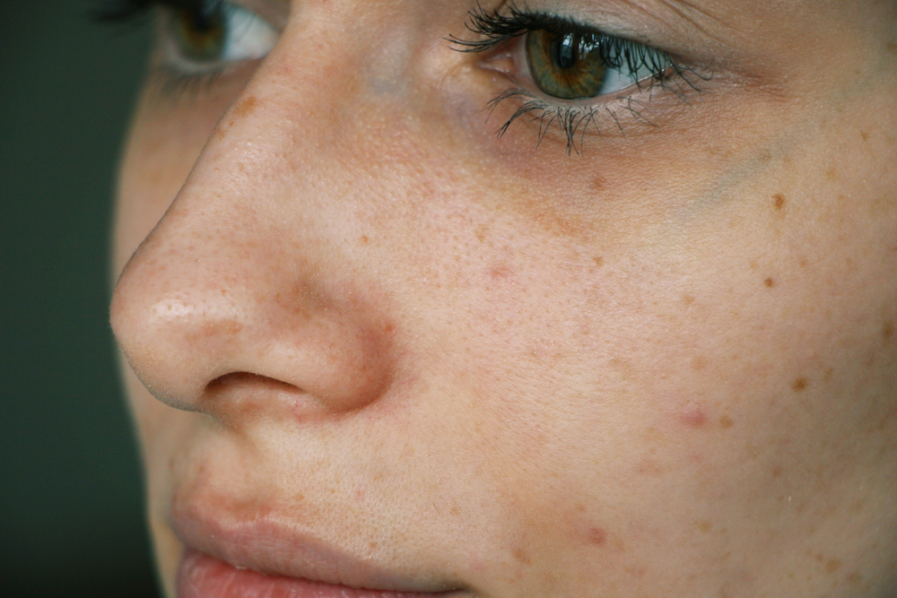A close up of a young woman's eye area.