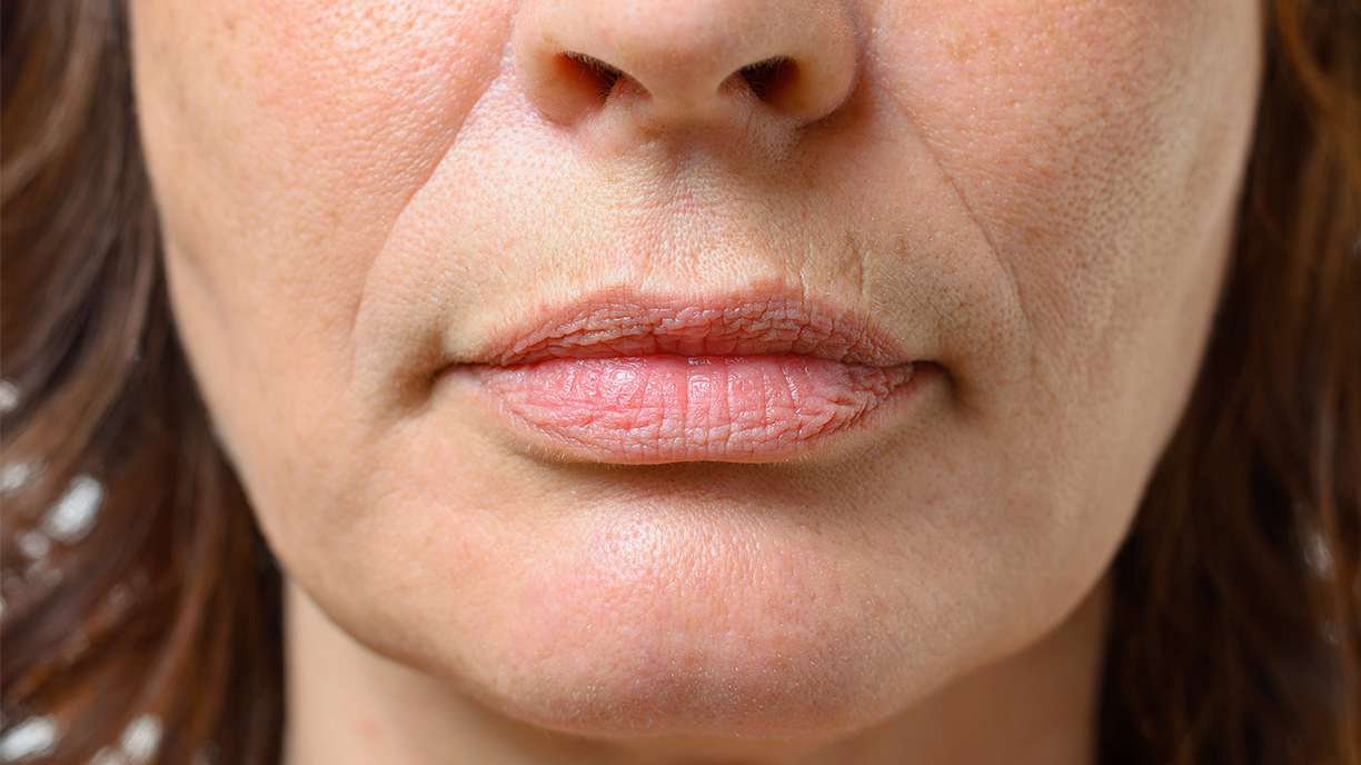 Close up of Woman's mouth area showing lines and wrinkles