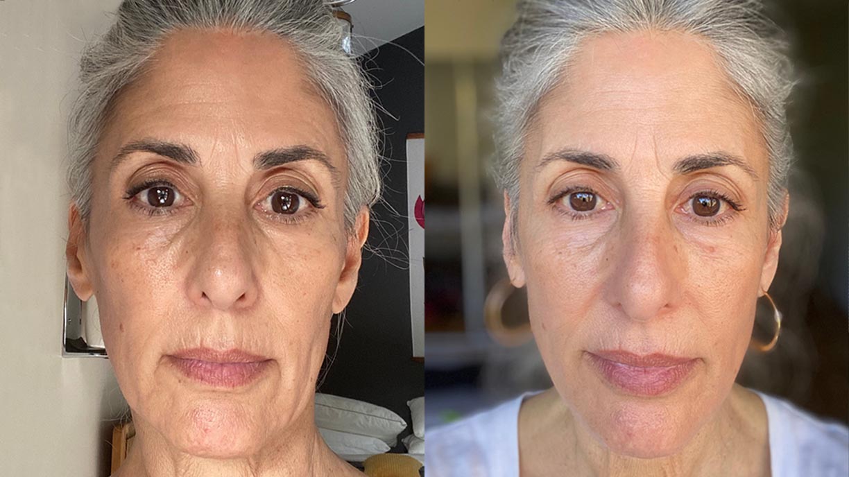 This photo features a before an after of Tami. On the left is pre-coaching and the right is after several months of an Art of Skin Care protocol featuring Emepelle products. Most notably, her skin is firmer, glowing, and features less visible fine lines.
